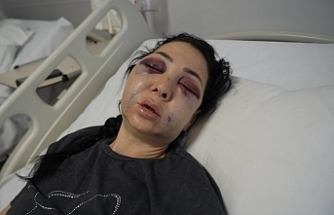 İzmit'te Kafe Dehşeti: Küfür Uyarısı Yapan Anne ve Oğluna Meydan Dayağı!