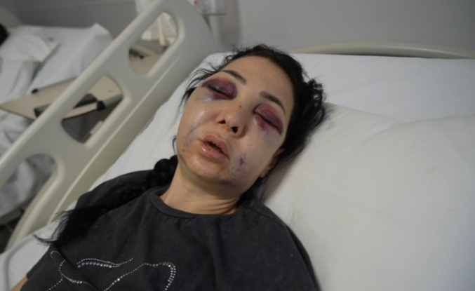 İzmit'te Kafe Dehşeti: Küfür Uyarısı Yapan Anne ve Oğluna Meydan Dayağı!